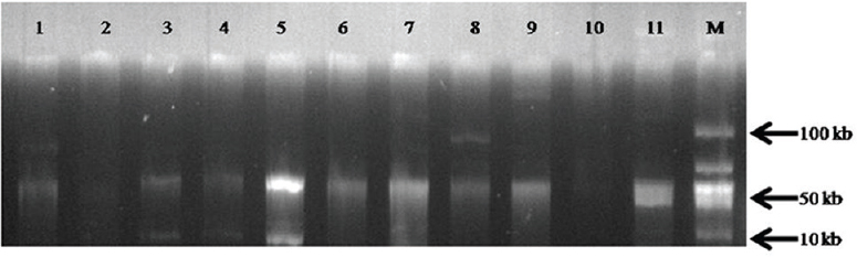 Profile of plasmids among the transconjugants and transformants. Lanes 1-11: Plasmid (50 kb) in transconjugants and transformants, M: Hyperladder (Bioline, UK).