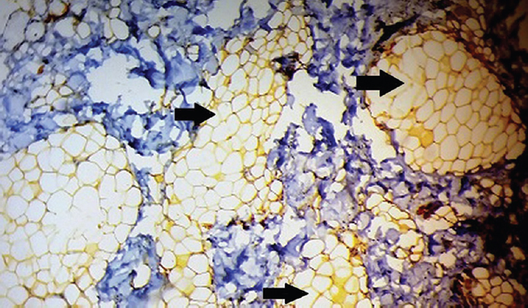 Section showing S-100 immunopositive adipose cells (×40). Arrows show S-100 immuno-positive adipose cells.