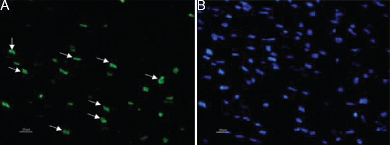 (A) The cells showing green fluorescence are TUNEL positive and (B) Hoechst (blue) shows nuclear stain, i.e., total number of cells.