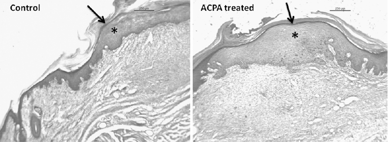 Histological evaluation of the wound after arachidonylcyclopropylamide (ACPA) treatment. There is comparable repair with re-establishment of continuity of the layers of the skin. Dermis (*) was thicker in the arachidonylcyclopropylamide-treated group. Site of incision indicated with an arrow. n=6 rats in each group. Bar - 250 μm.