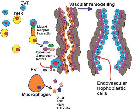 Schematic diagram showing the interaction of extravascular trophoblast, decidual natural killer cells and macrophages along with vascular remodelling. EVT, extravascular trophoblast; DNK cell, decidual natural killer cell; VEGF, vascular endothelial growth factor; FGF, fibroblast growth factor; MMP, matrix metalloproteinase, TGF, tumour growth factor.