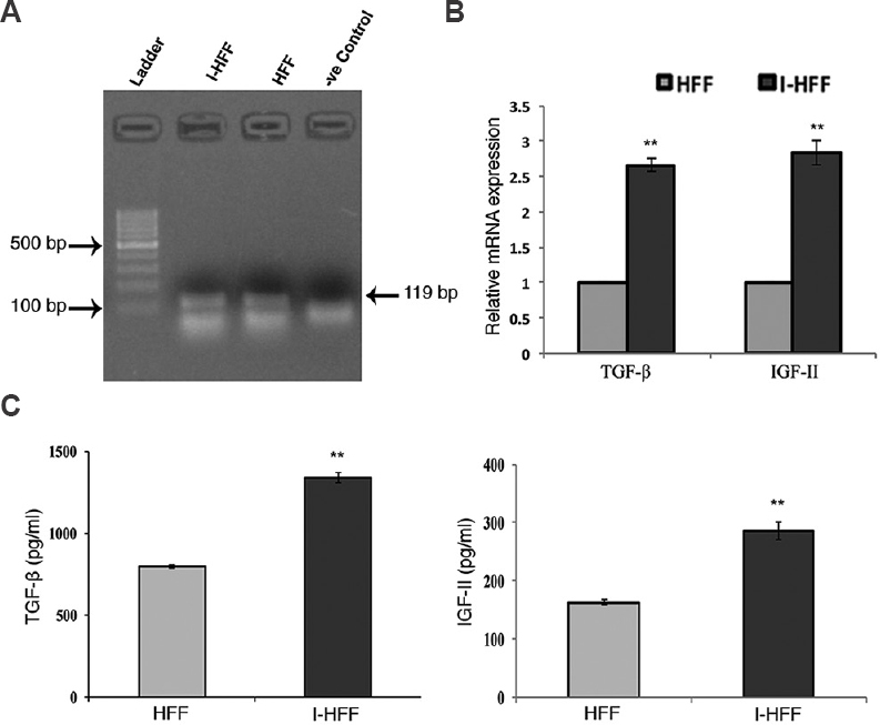 Gene expression and secretion of transforming growth factor-beta (TGF-β) and insulin-like growth factor-II (IGF-II) in I-HFF and HFF without addition of exogenous basic fibroblast growth factor (bFGF): (A) RT-PCR analysis showing gene expression of fibroblast growth factor receptor 1 (FGFR1) (size=119 bp) in I-HFF and HFF (lanes 2 and 3, respectively); (B) Expression levels of TGF-β and IGF-II in I-HFF relative to HFF using qPCR; and (C) Quantification of secreted TGF-β and IGF-II in the medium of I-HFF and HFF cells in the absence of exogenous bFGF using ELISA. Results are mean±standard deviation of five independent experiments. **P<0.01 compared to HFF.