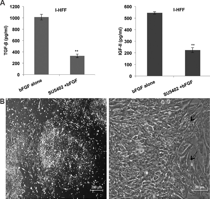 Demonstration of bFGF role in maintaining stemness of human embryonic stem cell using chemical inhibitor (SU5402) of FGFR1: (A) Effect of inhibitor on secreted amount of TGF-β and IGF-II released by I-HFF in presence of bFGF. Results are mean±standard deviation of three independent experiments. **P<0.01 compared to bFGF alone; and (B) Phase contrast images of KIND-1 human embryonic stem cells showing visible differentiation (black arrow). The cells were cultured in conditioned medium from inhibitor-treated I-HFF.