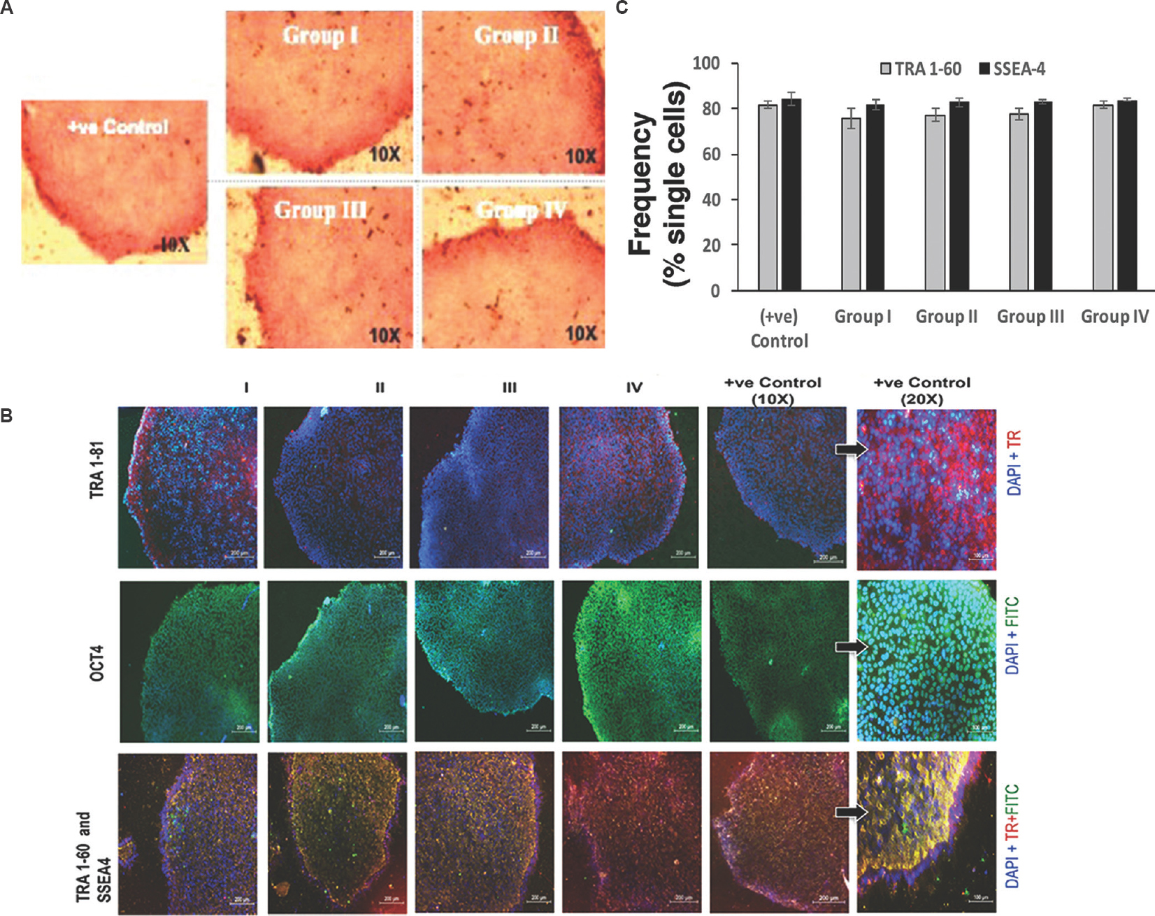 Characterization of hESCs pluripotency by immunostaining in the presence (Groups II, III and IV) or absence (Group I) of bFGF: (A) Alkaline phosphatase (AP) staining. Scale bar=10 μm, magnification ×10; and (B) Immunofluorescence images of KIND-1 hESC for undifferentiated stem cell surface markers. Texas red (TR) for TRA 1-81 and TRA 1-60 positive cells; green colour FITC for OCT4 and SSEA4 positive cells and blue colour DAPI for cell nuclei staining. Scale bar=200 μm, magnification ×10. KIND-1 hESC (positive control) at higher magnification ×20, scale bar=100 μm. (C) Comparative analysis of expression for pluripotent surface markers for TRA1-60 and SSEA-4 using flow cytometry (n=4), and represented as frequency of single cells.