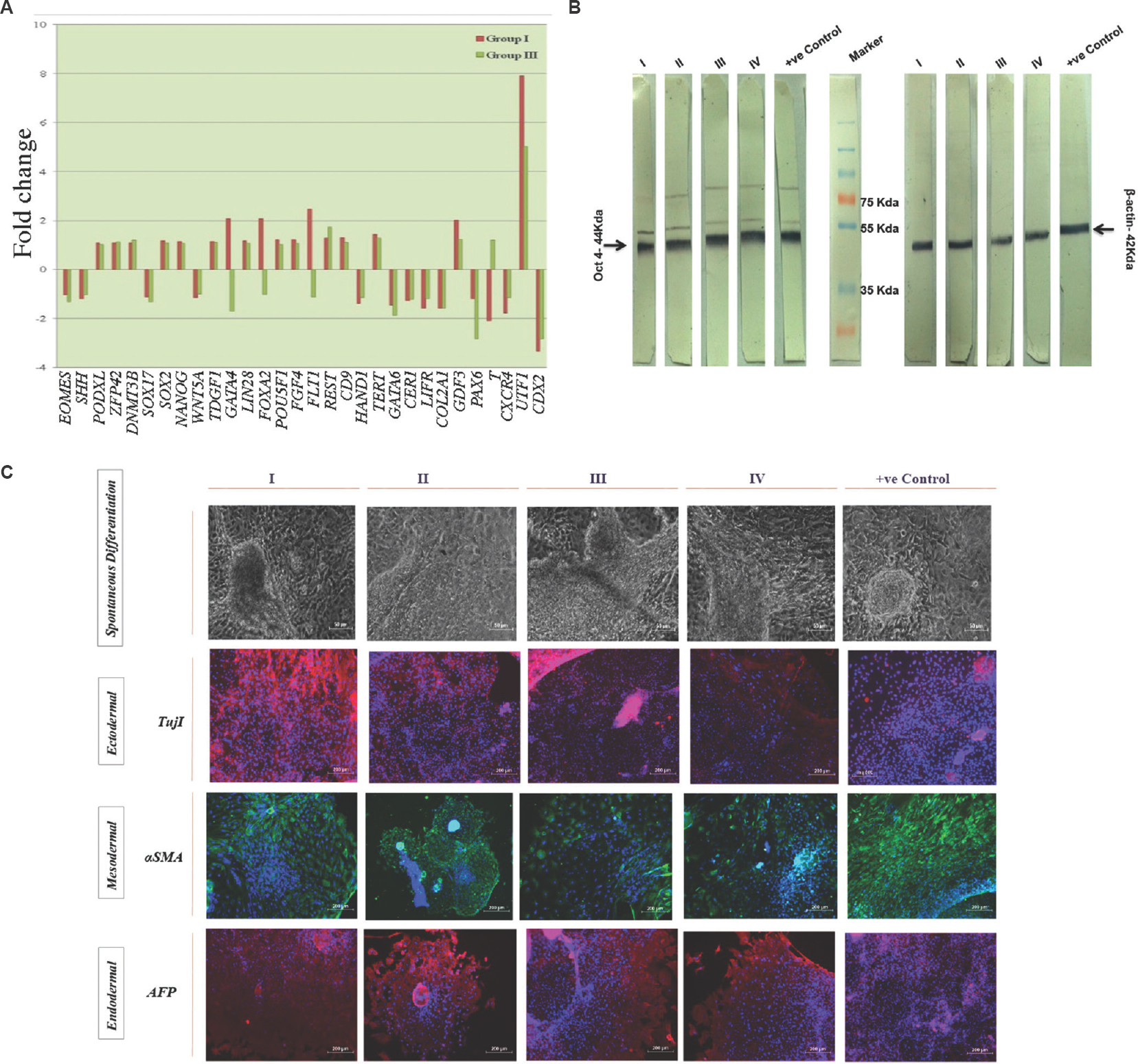 Gene and protein expression study of KIND-1 hESCs involved in pluripotency maintenance in I-HFF-conditioned medium lacking exogenous bFGF in feeder-free system: (A) Global Pattern Recognition™ Fold Change Values. The top 30 genes involved in pluripotency and early differentiation are shown; (B) Western blot analysis of KIND-hESC cultured under I-HFF-conditioned medium from groups I-IV. Loading control β-actin. Result shows representative membrane of three independent experiments; and (C) Protein expression analysis of lineage markers for three germ layers. Magnification ×10, scale bars=50 μm for first panel (spontaneous differentiation) and 200 μm for ectodermal, mesodermal and endodermal.