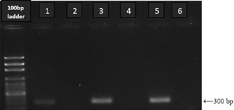 Agarose gel showing polymerase chain reaction product of GroEl gene of Orientia tsutsugamushi blood samples of animals [Lane 1: Positive control; Lane 6: Negative control; Lanes 2 & 4: animal samples (Negative); Lane 3: animal sample no. 23 (Positive); Lane 5: animal sample no. 46 (Positive)].