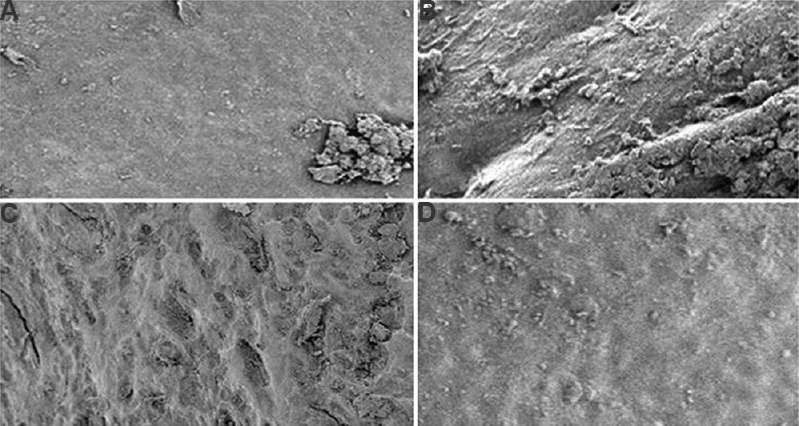 Scanning electron micrographs of knee joint articular surface of collagenase induced osteoarthritis in male albino rats. Control (A), arthritis control (B), gold nanoparticle (GNP)-Naja kaouthia cytotoxin 1 (NKCT1) treated (C), NKCT1 treated (D). Magnification= ×350.