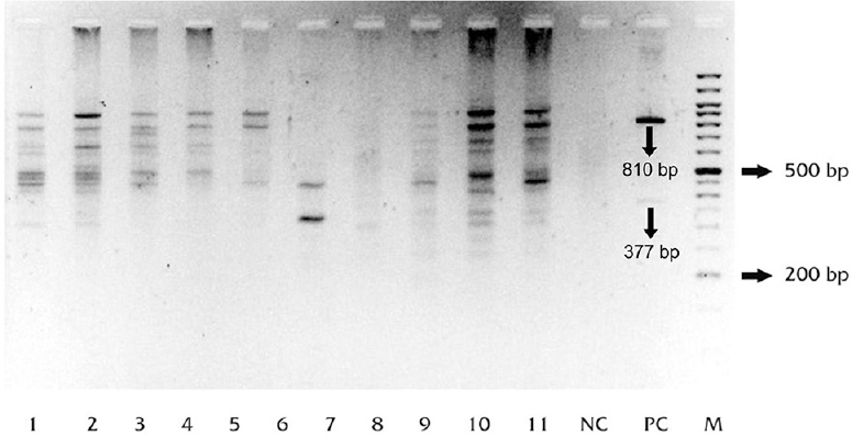 Agarose gel image showing random amplified polymorphic DNA (RAPD) profiles of Mycobacterium tuberculosis (MTB) isolates from the two slums. Lanes 1-11, samples (isolates from the slums); NC, no-template control; PC, positive control (M. tuberculosis strain H37Rv).