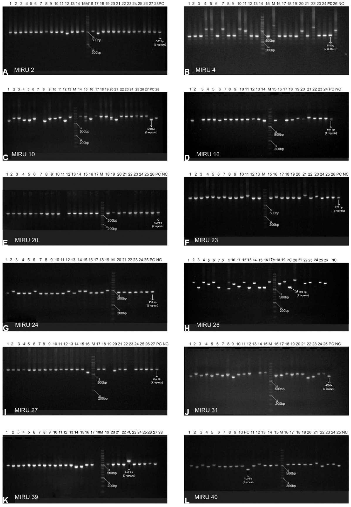 Agarose gel images of mycobacterial interspersed repetitive units-variable number of tandem repeats (MIRU VNTR). Panels (A-L) depict MIRU 2, 4, 10, 16, 20, 23, 24, 26, 27, 31, 39 and 40. In each panel lanes are marked as M, 100 bp DNA marker; various lanes, MIRU VNTR profiles of the isolates; NC, MIRU fingerprint of no-template control for the respective locus; PC, MIRU fingerprint of positive control (M. tuberculosis strain H37Rv) for the respective locus.