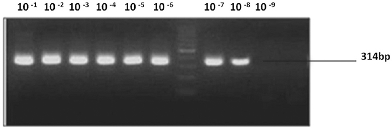 Sensitivity of Malsoor virus; nested reverse transcription polymerase chain reaction.