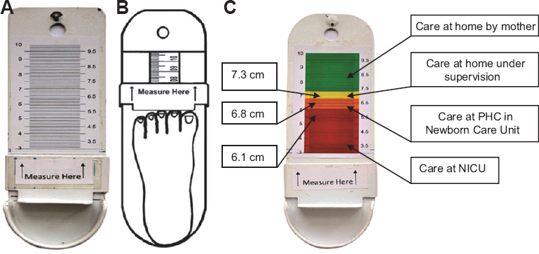 (A) Foot length calliper with scale only, (B) foot length calliper showing accurate method of measurement of foot length. (C) Action-oriented colour-coded foot length calliper. NICU, Neonatal Intensive Care Unit.