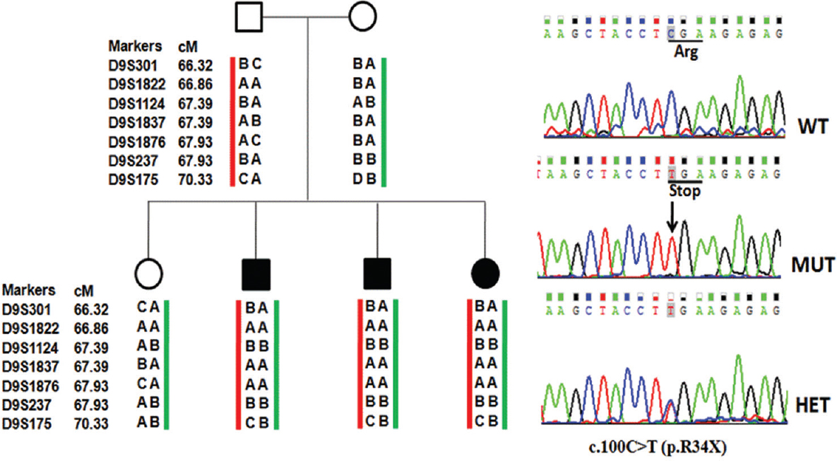 Pedigree and haplotypes (family DDL4), co-segregating nonsyndromic autosomal recessive hearing loss (filled symbols) with short tandem repeat markers at the DFNB7/11 locus. Sequence chromatogram of transmembrane channel like 1 gene showing homozygous change c.100C>T (p.R34X) in hearing impaired children, parents and normal hearing child are heterozygous for c.100C>T.