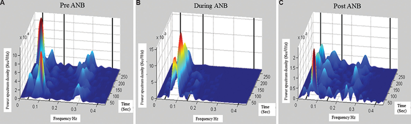 Frequency distribution in power spectrum of RR intervals in time-frequency domains. (A) Pre-alternate nostril breathing (B) during-alternate nostril breathing and (C) post-alternate nostril breathing. In during-ANB, maximum power is at 0.08 Hz, similar to respiratory frequency. It explains that the increase of low frequency power during-alternate nostril breathing is the supplementary because of respiration.