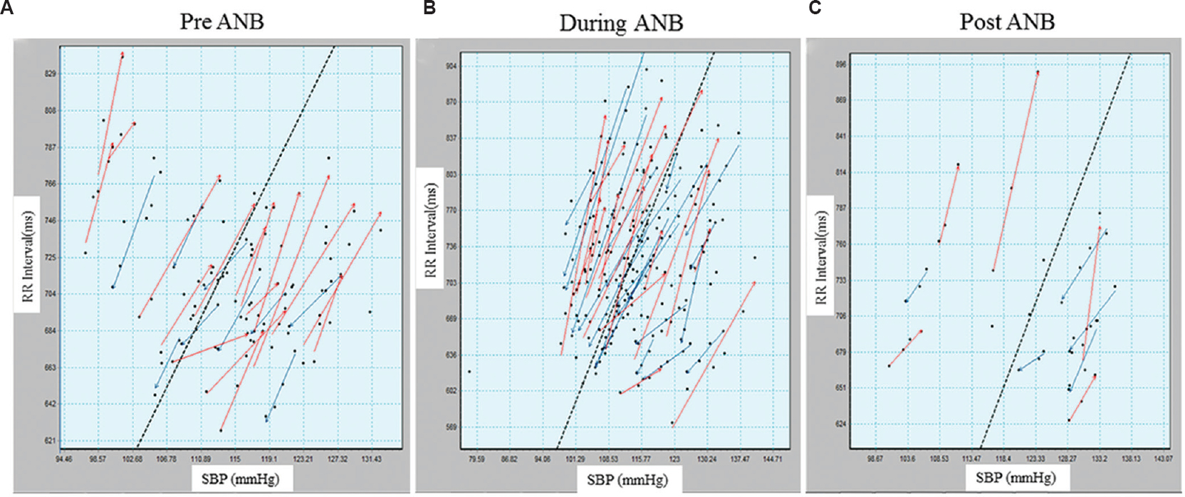 Baroreflex sensitivity by sequence method, up sequences in red arrows and down sequences in blue arrows, (A) pre-alternate nostril breathing, (B) during-alternate nostril breathing and (C) post-alternate nostril breathing. In during-alternate nostril breathing, number of up and down sequences significantly increased.