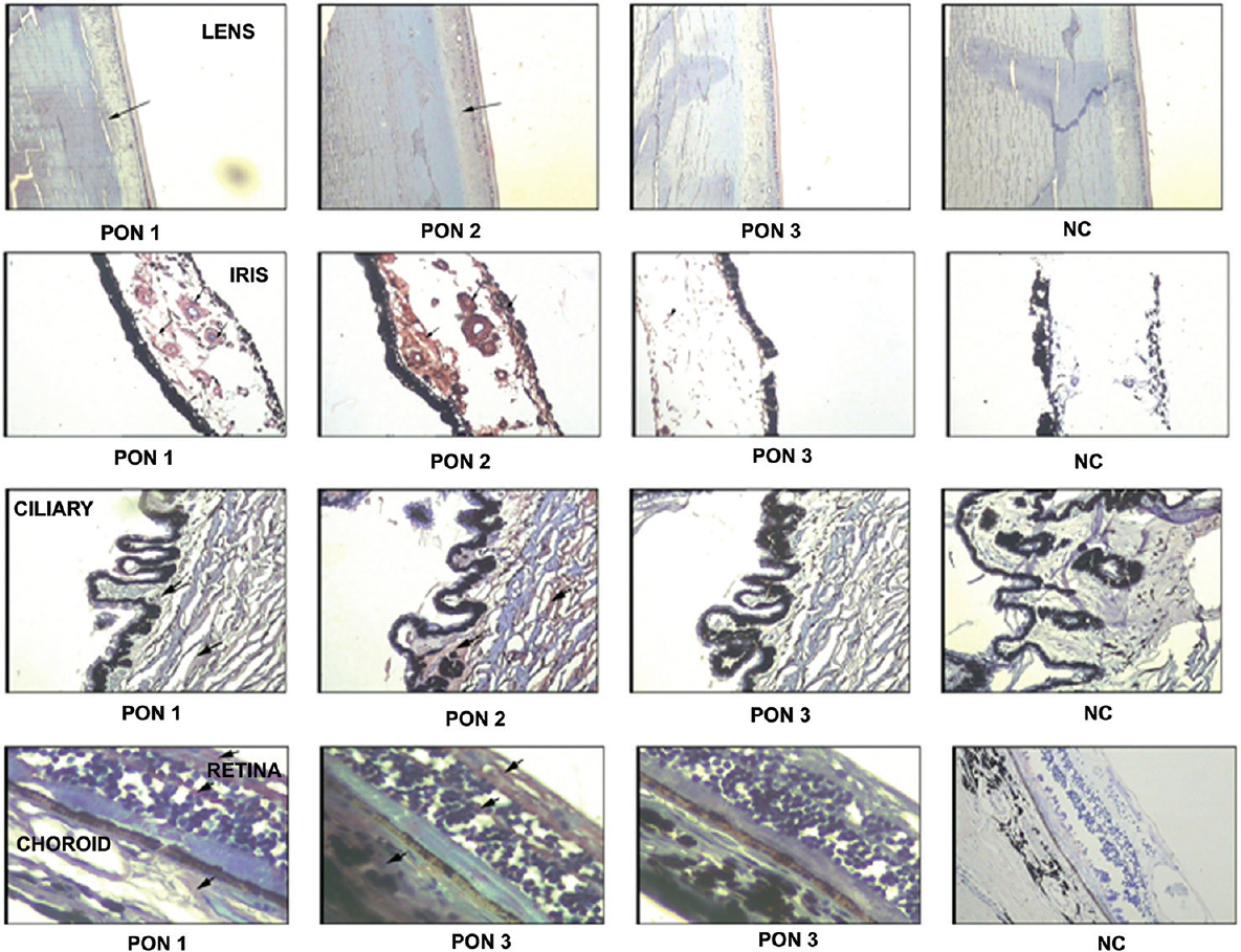 Tissue distribution of paraoxonase 1, 2 and 3. Immunolocalization of paraoxonase in paraffin-embedded sections in normal human donor ocular tissue. Arrow: positive labelling (reddish brown) of the lens, ciliary body, iris, choroid/retinal pigment epithelium and retina, haematoxylin was used as the counterstain. A negative control (NC) was run for all the paraoxonase genes by omitting the primary antibody.