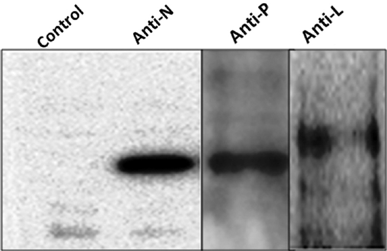 Expression of N, P and L genes in CV-1 cells detected by immunoblotting; Whole-cell lysates from CV-1 cells infected with vTF7-3 and then transfected with pET3a-NC, pET3a-PC or pRSFDuet-1-LC plasmids were immunoblotted with antibodies specific for N, P or L proteins. As a control, cells infected with vTF7-3 and then transfected with empty vectors were used. Blots for each protein along with controls have been developed separately, but only one control is shown here.