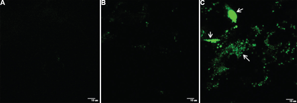 Expression of green fluorescent protein from a positive-sense minireplicon of Chandipura virus; (A) CV-1 cells infected with vTF7-3 only. (B) CV-1 cells infected with vTF7-3 and transfected with MGCG and empty vector. (C) CV-1 cells infected with vTF7-3 and transfected with MGCG and helper plasmids expressing Chandipura virus N, P and L proteins (arrows).