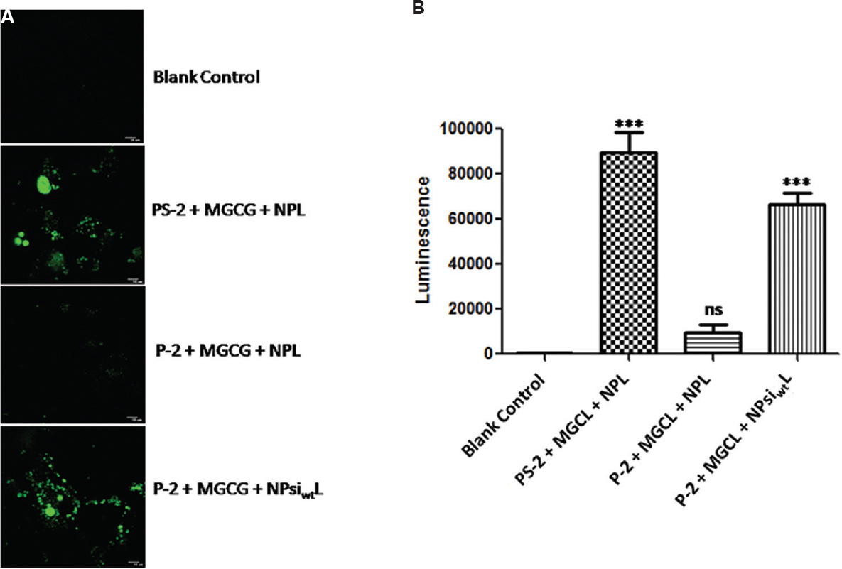 Chandipura virus P protein is essential for the minigenomes; siRNA knockdown-rescue experiment was performed to show the importance of P protein for Chandipura virus minigenome expression. (A) Effect of siRNA knockdown and subsequent rescue on green fluorescent protein minigenome. CV-1 cells infected with vTF7-3 and transfected with the indicated siRNA and plasmids were visualized by confocal microscopy. (B) siRNA knockdown-rescue on luciferase minigenome. Luminescence was measured after differential treatment of luciferase minigenome as shown in the Figure. Result is expressed as mean±standard error of mean (n=3). ***P <0.001 compared to blank control; ns, not significant. P-2, siRNA against CHPV P protein; PS-2, scrambled form of P-2; MGCG, minigenome construct expressing GFP; MGCL, minigenome construct expressing luciferase; NPL, all three helper plasmid clones: pET3a-NC, pET3a-PC and pRSFDuet-1-LC; NPsiwtL, a P-2 siRNA-resistant P protein clone used as the helper plasmid, instead of pET3a-PC along with pET3a-NC and pRSFDuet-1-LC.