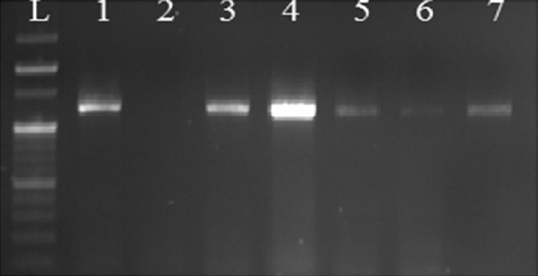Gel image showing amplification of Pseudomonas-derived cephalosporinases gene: Lane L, 100 bp DNA ladder; lanes 1, 3, 4, 5, 6, 7, Pseudomonas-derived cephalosporinases gene (1243 bp); lane 2, negative control.