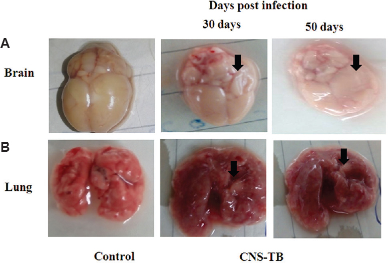 Representative photographs of (A) brains and (B) lung tissue of BALB/c mice with CNS-TB along with control at 30 and 50 days post-infection. Lungs and brains of both mice groups were visually examined for pathological changes compared to control. Lungs of mice with CNS-TB showed gross reduction in pathology at 50 days with progress in infection. Brains of infected mice showed swelling on left hemisphere which progressively increased with development of infection at 50 days. Arrows indicate gross lung and brain pathology in mice with CNS-TB.