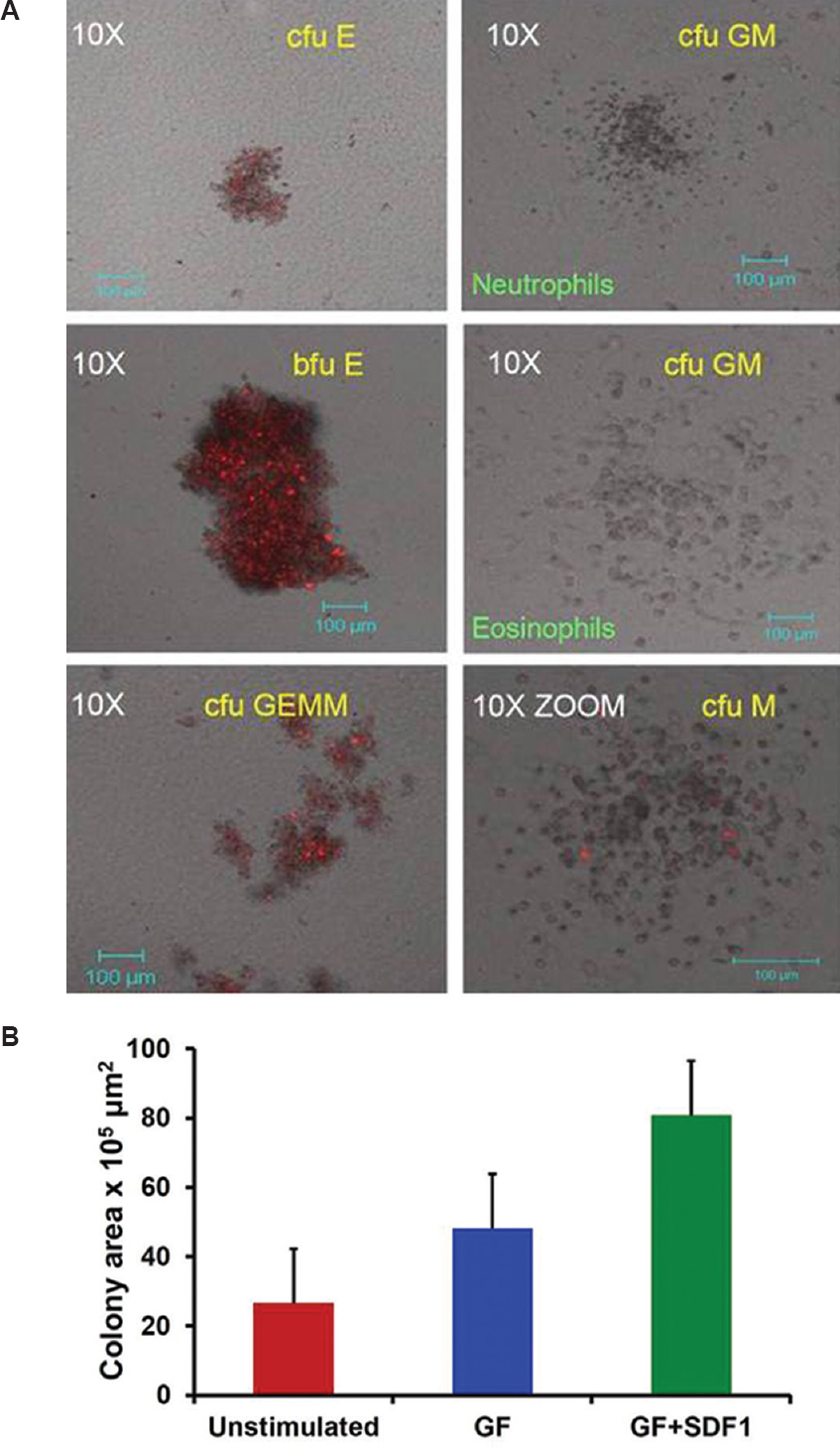 Stem cell progenitor assessment by colony formation assay (CFA). (A) Representative images of colony forming unit-erythrocyte (cfu-E), blast-forming unit-erythrocyte (bfu-E), colony-forming unit granulocyte macrophage (cfu-GM) (neutrophils), colony-forming unit granulocyte macrophage (cfu-GM) (eosinophils), cfu-granulocyte erythrocyte monocyte, megakaryocyte (cfu-GEMM), cfu-M colonies observed in CFA of enriched haematopoietic stem and progenitor cells under confocal microscope. Colonies were photographed after 14 days differentiation on methocult medium. (B) Stem cell progenitor assessment by colony formation assay. Total colony unit area (mean values) occupied by colonies generated by primitive and progenitor haematopoietic stem cells in ex vivo expanded haematopoietic stem and progenitor cells cultures (n=5).