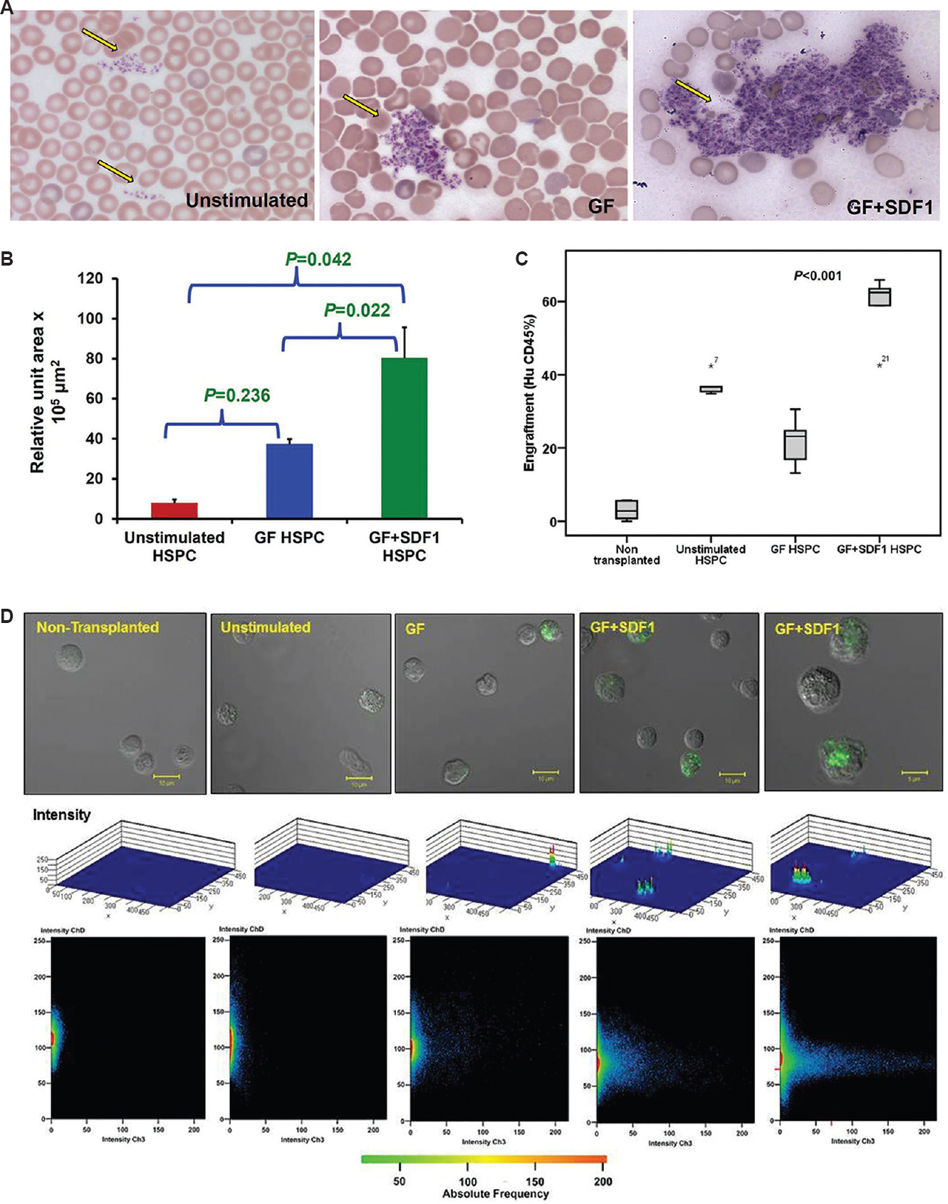 Assessment of in vivo engraftment potential of ex vivo expanded haematopoietic stem and progenitor cells in mice. (A) Microscopic images (×10) of platelets stained at six-week engraftment. Drop of blood from tail vein was smeared and slides were stained with May-Grunwald-Giemsa stain. Left panel depicts platelets in mouse transplanted with unstimulated haematopoietic stem and progenitor cells while right panel exhibits platelets in mouse transplanted with growth factor+stromal cell-derived factor 1 (GF+SDF1) stimulated haematopoietic stem and progenitor cells. Yellow arrow in both panels denotes location of platelets. (B) Assessment of in vivo engraftment potential of ex vivo expanded haematopoietic stem and progenitor cells in mice. Mean values (4 experiments) of relative unit area ×103 μm2 occupied by platelets in peripheral blood of mice. P values obtained by paired t test. (C) Assessment of in vivo engraftment potential of ex vivo expanded haematopoietic stem and progenitor cells in mice. Per cent human CD45+ cells in bone marrow of mice transplanted with no haematopoietic stem and progenitor cells, unstimulated haematopoietic stem and progenitor cells (HSPC), growth factor-stimulated haematopoietic stem (GF HSPC) and progenitor cells and growth factor + stromal cell-derived factor 1 stimulated haematopoietic stem and progenitor cells (GF+ SDF1 HSPC). This represents box plot of engraftment data (n=6 in each group). (D) Assessment of in vivo engraftment potential of ex vivo expanded haematopoietic stem and progenitor cells in mice. Top subpanel, confocal microscopic view, middle subpanel, 3D plot, and bottom subpanel, intensity plot of human CD45+ cells stained with fluorescein-isothiocyanate (FITC) in bone marrow of transplanted mice.