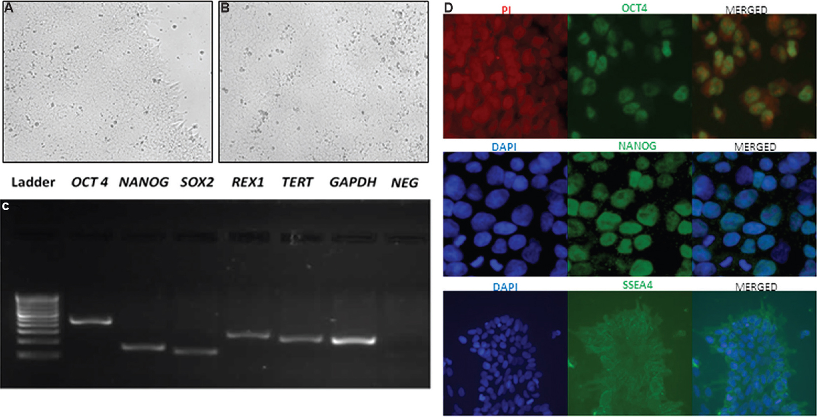 Human embryonic stem cells (KIND1) used for the study. (A & B) KIND1 human embryonic stem cells colony grown as monolayer under feeder-free conditions on a Geltrex-coated dish (×10). (C) Pluripotent transcripts amplified by reverse transcription polymerase chain reaction using KIND1 human embryonic stem cells OCT4 (octamer-binding transcription factor 4), NANOG, SOX2 (SRY-Box 2), REX1 (Reduced Expression Protein 1) and TERT (Telomerase Reverse Transcriptase). GAPDH was used as housekeeping gene. (D) Immunofluorescence staining revealed the localization of markers such as OCT4, NANOG and SSEA4 (stage-specific embryonic antigen-4) (×40) (top & middle panel) and ×20 (bottom panel). Counterstaining was done using PI for OCT4 while DAPI was used for NANOG and SSEA4.