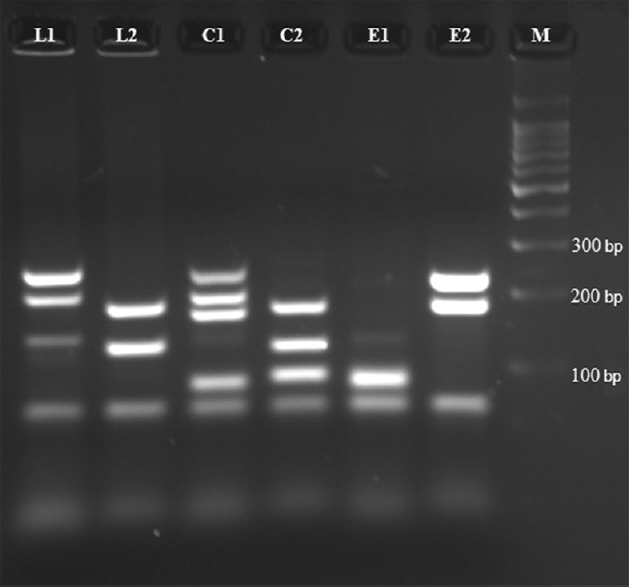 Amplicons of different sizes obtained by multiplex polymerase chain reaction. L1 & L2, Multiplex (M) 1 and M2 for S. Typhimurium (LT2 strain); C1 & C2, M1 and M2 for S. Typhi (CT18 strain); E1 & E2, M1 and M2 for S. Enteritidis (PT4 strain). M: 100 bp DNA ladder.