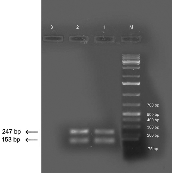 Polymerase chain reaction products using D.rep primers. Lanes M, DNA ladder; lanes 1-2, human isolates; lane 3, negative control.