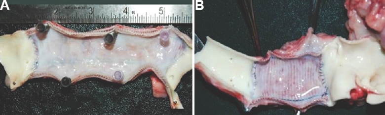 Gross photograph of the slit explanted graft at 26 wk showing thin, clean, glistening and lustrous neointima with tidy proximal and distal anastomosis and absence of thrombus in test graft (A) and control graft (B).