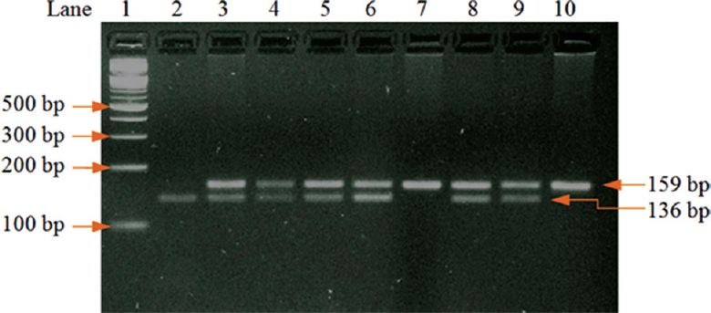 Gel picture showing the polymerase chain reaction-restriction fragment length polymorphism analysis; after digestion of PCR product with MaeI restriction enzymes (lane 1: 100 bp ladder; lane 2: CC homozygous genotype; lane 3, 4, 5, 6, 8, 9: heterozygous AC genotype; lane 7, 10: homozygous AA genotype.