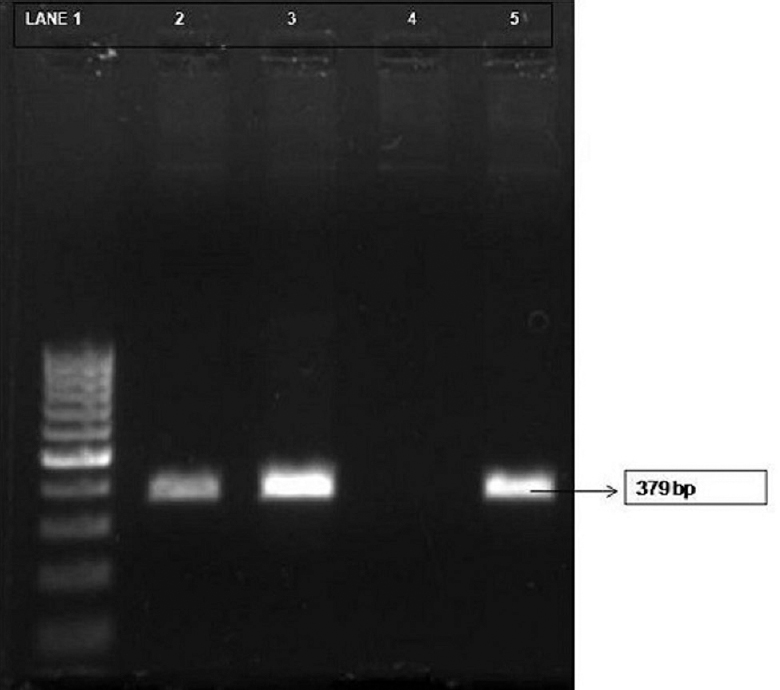 Polymerase chain reaction for Bartonella henselae citrate synthase gene (gltA). Lane 1, 100 bp DNA ladder; lane 2, clinical sample (laboratory no. 413) positive; lane 3, clinical sample (laboratory no. 738) positive; lane 4, negative control; lane 5, positive control (original image).