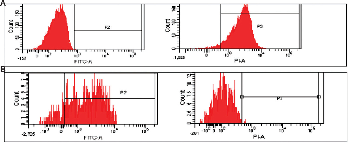 (A) High Bax mean fluorescence intensity in a case, PE (phycoerythrin) labelled; (B) high Bcl2 mean fluorescence intensity in a case, FITC (fluorescein isothiocyanate) labelled.