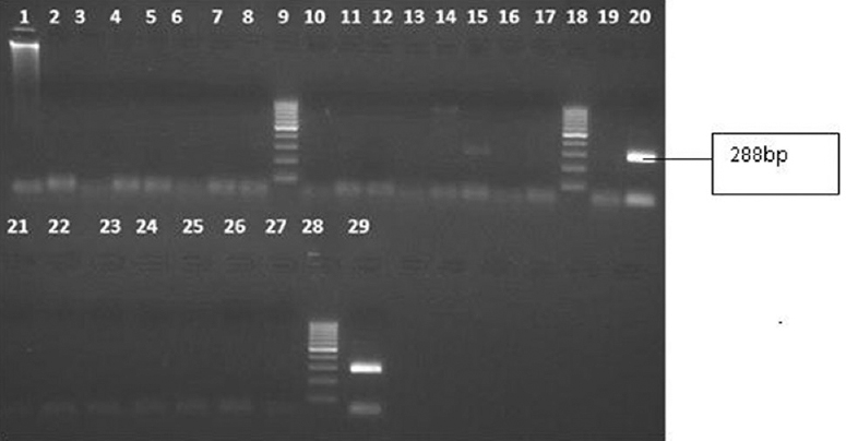 Gel picture showing amplification for parvovirus B19 positive sample in one patient with febrile illness. Lane 15, specific bands for parvovirus B19 (288 bp); lanes 20 and 29, positive control for parvovirus B19 (288 bp); lanes 9, 18 and 28, molecular weight marker; lanes 1, 2, 4, 5, 7, 8, 11, 12, 14, 17, 19, 22, 23, 25 and 26, patients samples; lanes 3, 6, 10, 13, 16, 21, 24 and 27, negative controls.