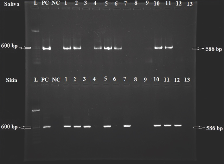 Agarose gel (1%) stained with ethidium bromide. Lanes L, 100 bp ladder; NC, negative control; PC, positive control; 1-13, saliva samples (top lanes) and skin samples (bottom lanes).