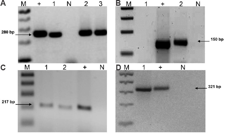 Agarose gel electrophoresis of PCR reaction products. (A) Representative agarose gel with PCR products of human beta-globin (280bp). (B) 150 bp PCR product using GP5+/GP6+ common primer for HPV. (C) PCR products of HPV-18 using specific primers FHPV-18/RHPV18 (217bp). (D) PCR products of HPV-16 using specific primer FHPV-16/RHPV16 (321bp). M, 100 bp molecular weight marker, (+) positive control: in (A) human DNA, in (B and C) Ca Ski cells DNA, in (D) HeLa cells DNA. N, negative control without DNA. Numbers 1 to 3 correspond to PCR products using DNA from human cervical samples.