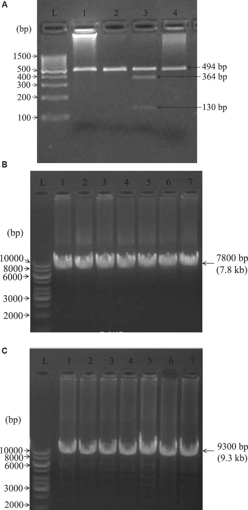 Restriction fragment length polymorphism (RFLP) results of PCR products digested with Apa1 enzyme. (A) Lanes 1, 2 and 4 bands were negative for A3243G mutation. In lane 3, the 494 bp products with A3243G mutation were cleaved into 364 and 130 bp fragments (mitochondrial encephalomyopathy, lactic acidosis, and stroke-like episodes DNA-positive control). L denotes 100 bp DNA ladder. (B) Lanes 1-7 indicate the number of amplified DNA and L denotes 1 kb DNA ladder. The mitochondrial genome of all the patients was amplified in 7800 bp (7.8 kb) indicating the absence of large scale deletions. (C) Lanes 1-7 indicate the number of amplified DNA and L denotes 1 kb DNA ladder. The mitochondrial genome of all the patients was amplified in 9300 bp (9.3 kb) indicating the absence of large scale deletions.
