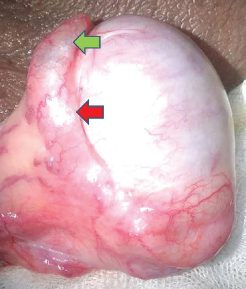 Epididymis (×8) showing blue hue at the caput (green arrow) suggesting an underlying tubule rupture and flaccid body and tail (red arrow).