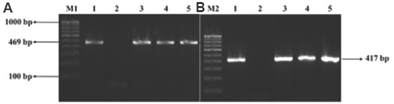 Agarose gel electrophoresis image of PMQR genes (A) M1: 100 bp DNA ladder; lane 1: qnrB PCR product; lane 2: negative control; lanes 3-5: isolates positive for qnrB. (B) M2: 100 bp DNA ladder; lane 1: qnrS PCR product; lane 2: negative control; lanes 3-5: isolates positive for qnrB. PMQR, plasmid-mediated quinolone resistance.