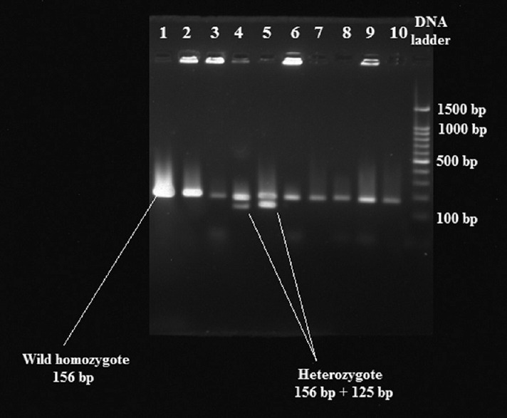 Polymerase chain reaction-restriction fragment length polymorphism of oestrogen receptor fragments. Lanes 2, 6 and 9 heterozygote (Rr); lanes 1, 3, 4, 5, 7, 8 and 10 wild- type homozygote (rr); last lane, DNA ladder.