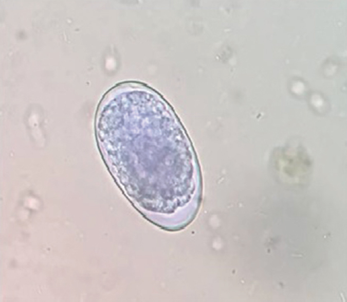 Hookworm eggs in saline mount (×40).