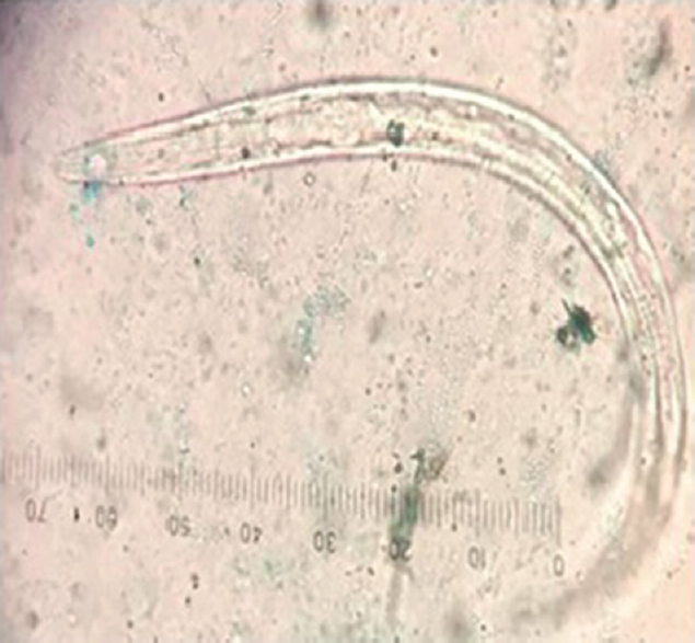 Filariform larvae L3 of Ancylostoma duodenale and Necator americanus in agar plate culture (×40).