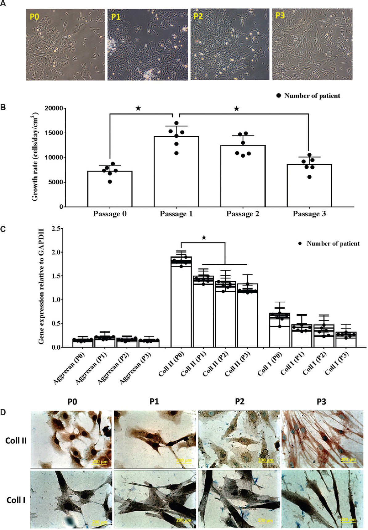 (A). Photomicrographs (×40) of human osteoarthritis chondrocytes at day 7 from P0, P1, P2 and P3. After seven days of in vitro culture, all chondrocytes demonstrated polygonal morphology. (B) The growth rate of cultured chondrocytes decreased over successive passages *P<0.05. (C) Gene expression for collagen types I and II reduced after several passages, whereas aggrecan gene expression was consistently expressed. (D) Prominent staining of collagen type II in P0 detected by immunocytochemistry, which became weaker by P3. Collagen type I staining was observed for all passages.