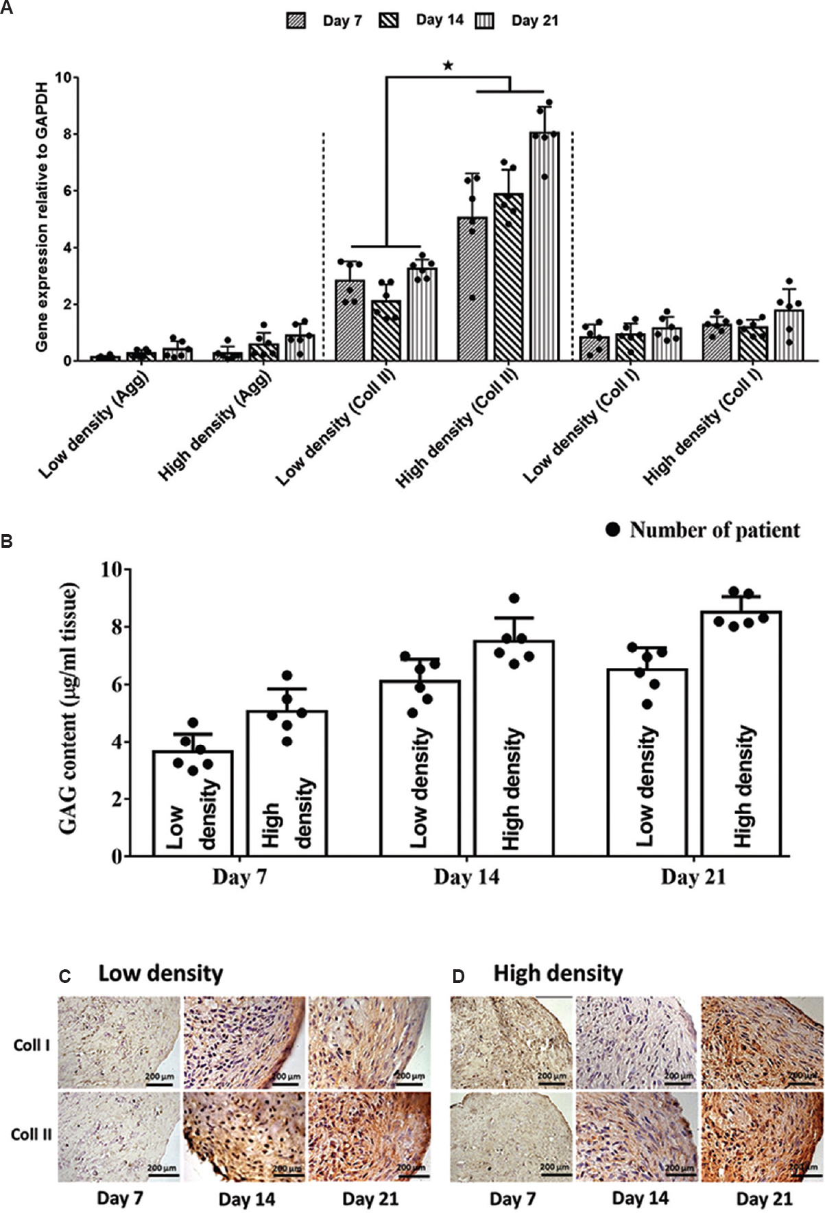 (A) Significant (*P<0.05) expression of collagen type II (coll II), particularly in high-density seeded cells. All evaluated genes showed progressive expression throughout the culture period. Constructs showed strong expression of collagen type II in the pericellular matrix area and throughout the extracellular matrix, confirming an immature cartilage phenotype at days 14 and 21 for both groups glyceraldehyde phosphate dehydrogenase (GAPDH) and glycosaminoglycan (GAG) (B). Proteoglycan deposition showed no significant differences between constructs (C&D). Immunohistochemistry staining. Collagen type I and II (coll I & II) deposition was also detected in both constructs at day 7, 14 and 21 in low and high seeding chondrocytes fibrin construct.