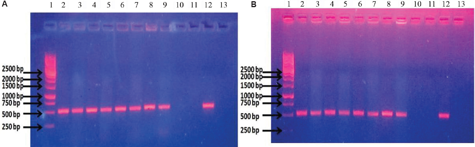 (A) Conventional wet mix PCR with malB primers. Lane 1: ladder; lanes 2 and 3: Shigella flexneri DNA; lanes 4 and 5: S. sonnei DNA; lanes 6 and 7: clinical isolate of Shigella DNA; lanes 8 and 9: uropathogenic Escherichia coli (UPEC) U110 DNA; lanes 10 and 11: Klebsiella pneumoniae DNA; lane 12: malB clone as template for positive control; lane 13: blank. (B) Dry-reagent PCR with malB primers. Lane 1: ladder; lane 2: S. flexneri DNA; lane 3: S. flexneri culture; lane 4: S. sonnei DNA; lane 5: S. sonnei culture; lane 6: clinical isolate of Shigella DNA; lane 7: clinical isolate of Shigella culture; lane 8: UPEC U110 DNA; lane 9: UPEC U110 culture; lane 10: K. pneumoniae DNA; lane 11: K. pneumoniae culture; lane 12: malB clone as template for positive control; lane 13: blank.