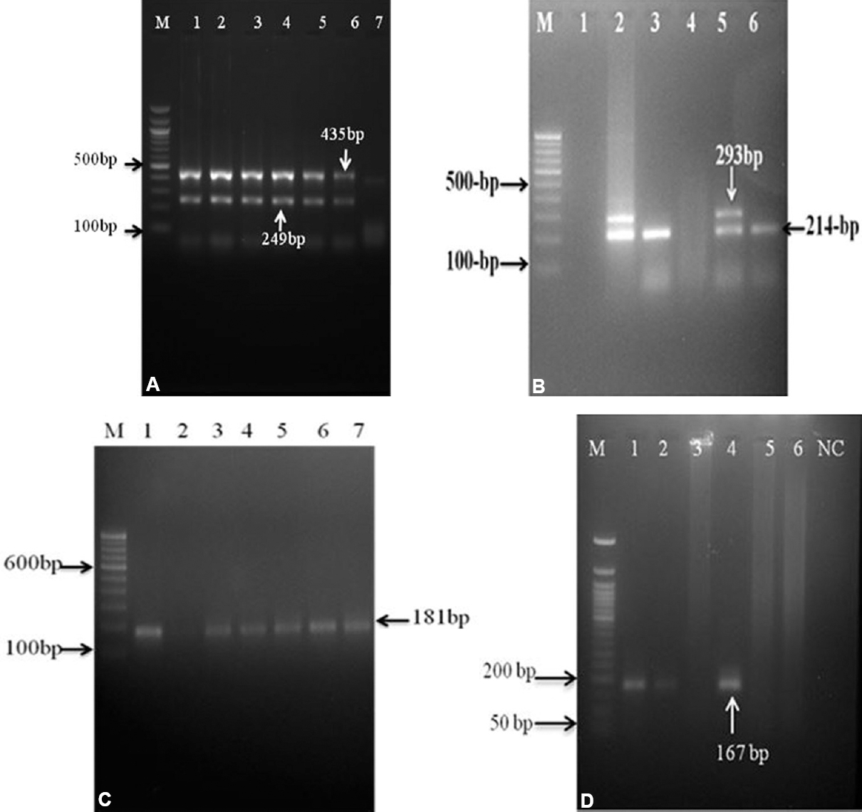 Gel images of allele-specific PCR assays with clinical specimens DNA preparation: (A) First step nested multiple allele-specific PCR with outer rpoB and katG derived primers. M- 100 bp ladder; lane 1- H37Rv strain; lanes 2 to 6- strains with outer region of codon rpoB and katG genes; lane 7- negative control. (B) Analysis of rpoB516 codon and katG315 codon by nested multiple allele-specific PCR assay. Lane 1- negative control ; lane 2- H37Rv strain; lane 3- isolate with katG315 mutant allele (AGC-ACC); lane 4 - isolate with rpoB516 mutant allele (GAC-GTC, TAC and GGC) and katG315 mutant allele (AGC-ACC); lane 5- isolate with rpoB516 wild-type allele and katG315 wild-type allele; lane 6- isolate with rpoB516 wild-type allele and katG315 mutant allele (AGC-ACA); M- 100 bp DNA ladder; (C) Analysis of rpoB526 codon by nested allele-specific-PCR assay. Lane 1- H37Rv strain; lanes 2 to 7- isolates with rpoB526 wild-type allele; lane 3- isolate with rpoB526 mutant allele (CAC-GAC, TAC and CTC); (D) Analysis of rpoB531 codon by nested allele-specific PCR assay. M- 50 bp DNA ladder; lane1- H37Rv strain; lanes 2 and 4- isolates with rpoB531 wild-type allele; lanes 3, 5 and 6- isolates with rpoB531 mutant allele (TAC-TCG and); NC, negative control.