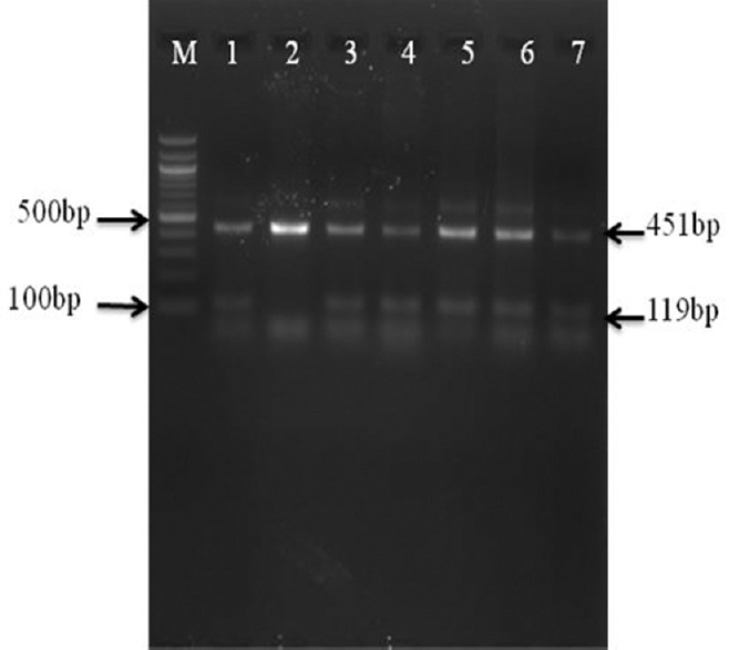 Gel image of mabA single step multiple allele-specific PCR assay with clinical specimens DNA preparation: Analysis of mabA-inhA promoter region by multiple allele-specific PCR assay M-100 bp DNA ladder; lane 1- H37Rv strain; lane 2- isolate with a-15 C-T substitution in the promoter region of the inhA gene; lanes 3-7- isolates with the mabA-15 wild-type allele.