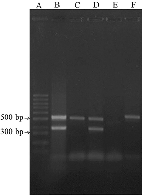 (A) Ladder 1000 bp, (B) positive control for eae and bfp genes, (C) positive isolate for eae gene, (D) positive isolate for eae and bfp genes, (E) negative control, (F) positive isolate for eae gene.