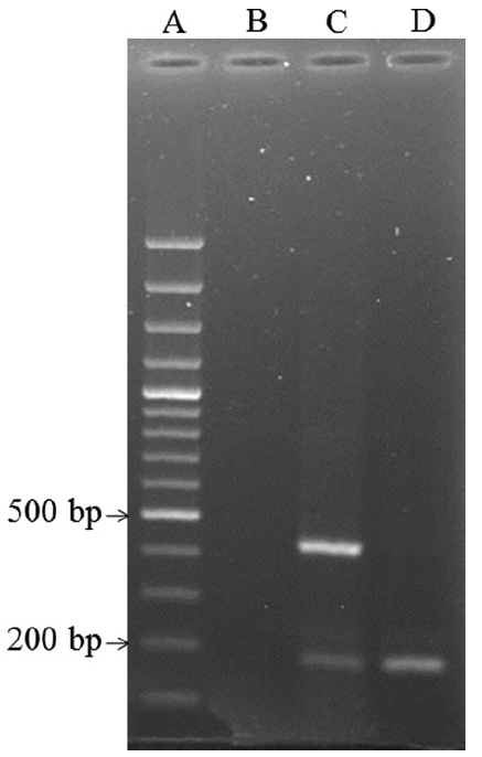 (A) Ladder 1000 bp, (B) negative control, (C) positive isolate for lt and st genes, (D) positive isolate for st gene.
