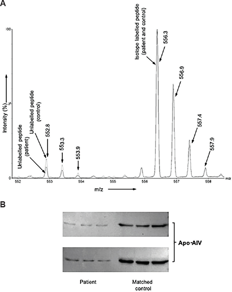 Relative quantification and Western blot analysis. (A) Depicts the overlaid electrospray ionization mass spectra of the doubly charged endogenous peptide of apolipoprotein A-IV 1104.6 m/z (552.8 m/z) and corresponding labelled peptide 1111.6 m/z (556.3 m/z) obtained from an individual with deliberate self-harm and the matched control. (B) Western blot images of individuals with deliberate self-harm and matched controls.